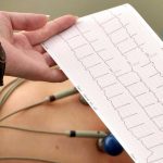 Electrocardiograma 12 derivaciones