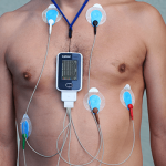 holter electrocardiograma 24hs