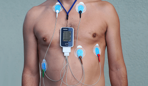 holter electrocardiograma 24hs